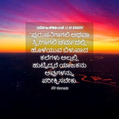Picture 04 - ಯಾಜಕಕಾಂಡ 13:38 KANIRV - “ಪುರುಷನಿಗಾಗಲಿ - Bible Verse Picture